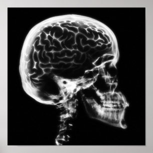 POSTER CERVEAU-CIEL X-RAY - NOIR ET BLANC