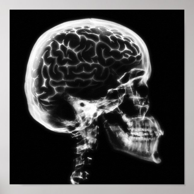 POSTER CERVEAU-CIEL X-RAY - NOIR ET BLANC (Devant)