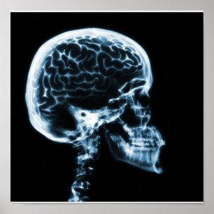 POSTER CERVEAU JUMEAU X-RAY - BLEU