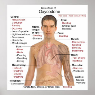 Poster Chart of the Main Side Effects of Oxycodone