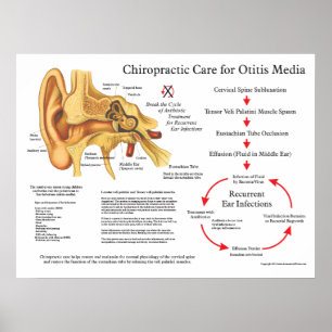Poster Chiropractic Care for Otitis Media Ear Infections