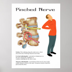 Poster Chiropratique de la thérapie physique du nerf broc