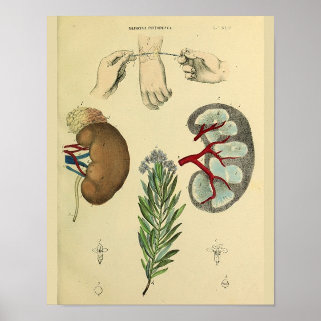 Poster Chirurgie au poignet Médicale Reins Anatomie Art I (Devant)
