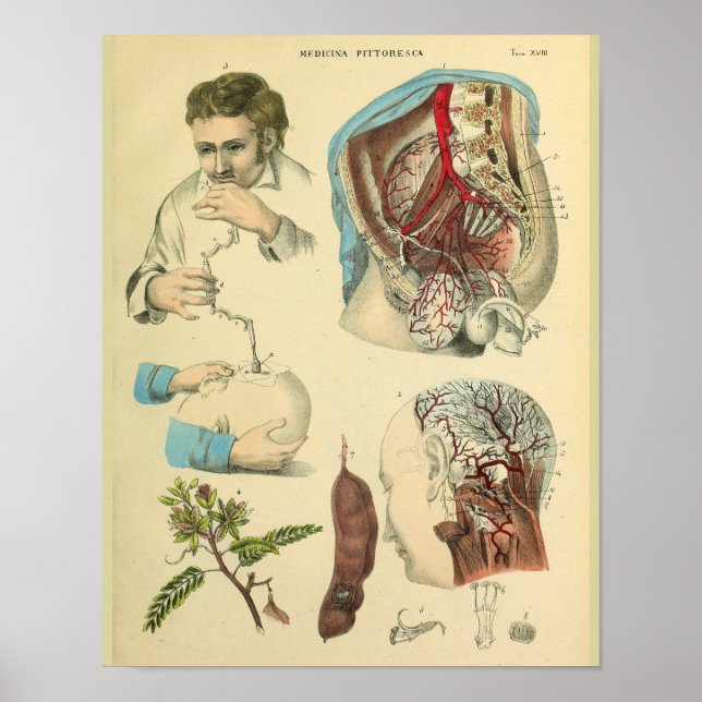 Poster Chirurgie cérébrale Tête Anatomie Art Docteur Impr (Devant)