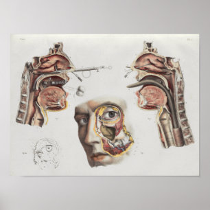 Poster Chirurgie Technique Médicale Anatomie Vintage Impr