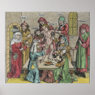 Poster Circumcision