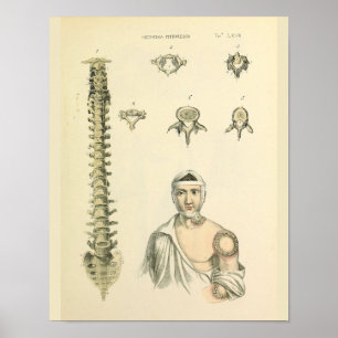 Poster Colonne de colonne vertébrale Anatomie Art Imprime
