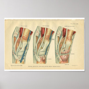 Poster Copie vintage d'anatomie de cheval de jambe