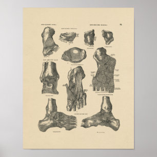 Poster Copie vintage de l'anatomie 1880 d'articulation de