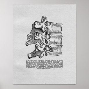 Poster Copie vintage de subluxation vertébrale de