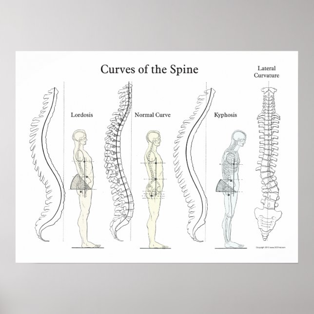 Poster Courbes de la colonne vertébrale Chiropratique (Devant)