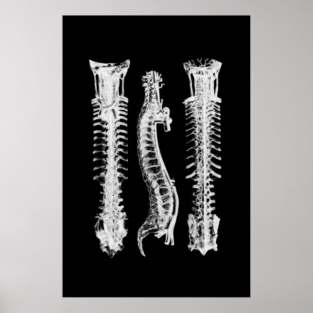 Poster d'art Médicale de décoration murale de l'an (Devant)