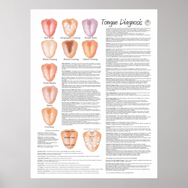 Poster de diagnostic de la langue chinoise de l'ac (Devant)