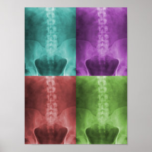 Poster de toile d'art numérique X-Ray