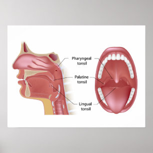 Poster de Tonsils