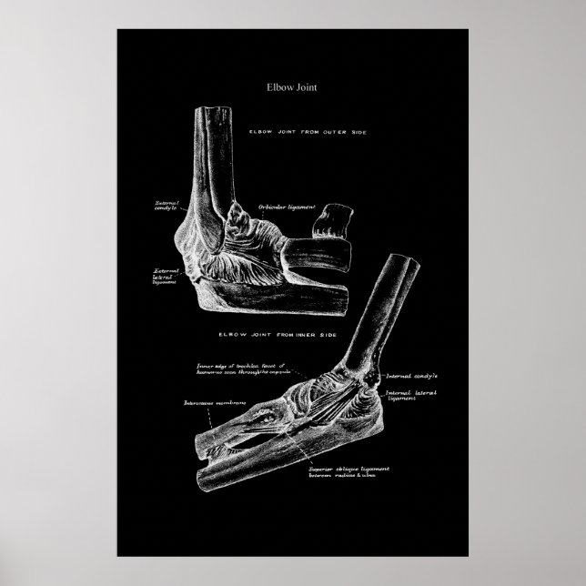 Poster Décor du mur orthopédique (Devant)