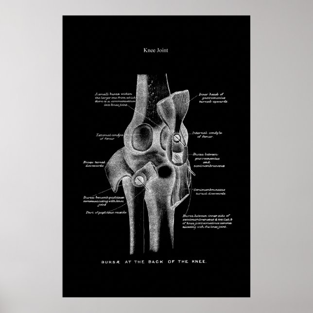 Poster Décor Médicale de l'anatomie articulaire du genou (Devant)