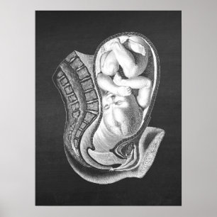 Poster Décor obstétrique anatomique de grossesse no 1