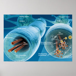 Poster Désintégration des microtubules dans un neurone