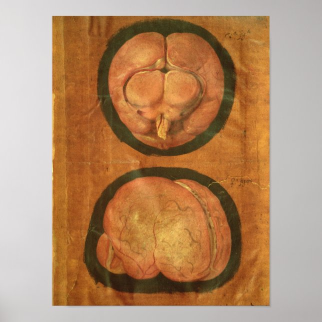 Poster Dessin anatomique du cerveau humain (Devant)