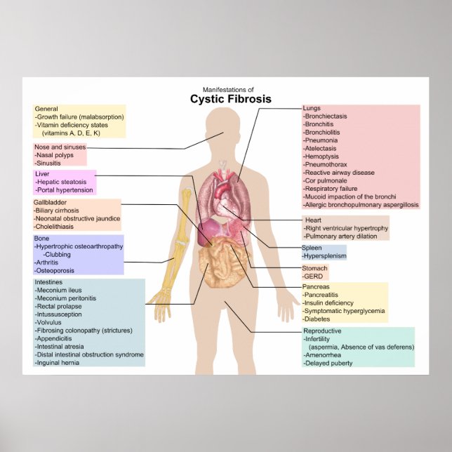 Poster Diagramme des manifestations de la fibrose kystiqu (Devant)