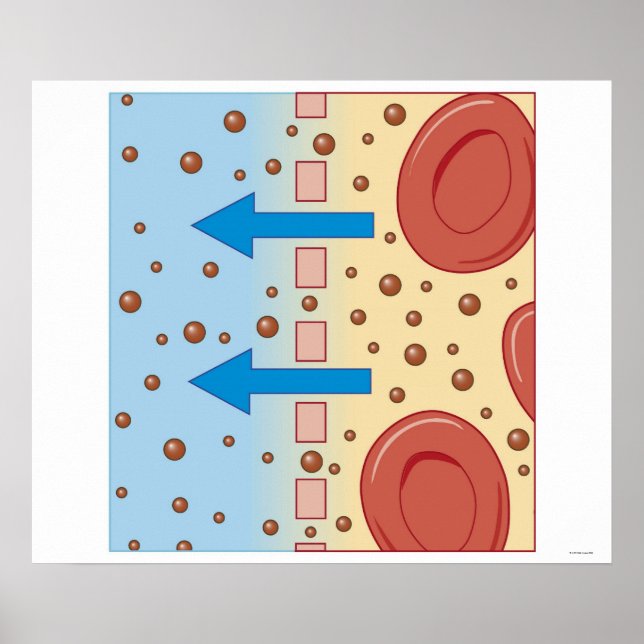 Poster Dialyse rénale (Devant)