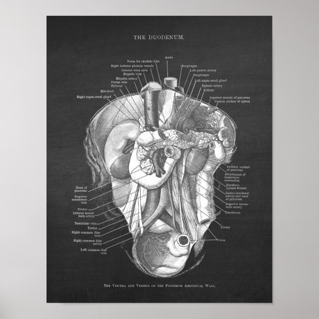Poster Duodenum Anatomie Art Gastroentérologue Décor (Devant)