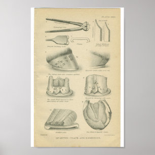 Poster Fissures vintages de sabot d'impression d'anatomie