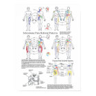 Graphique de référence de la douleur viscérale de 