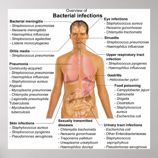Poster Graphique des principales infections bactériennes  (Devant)