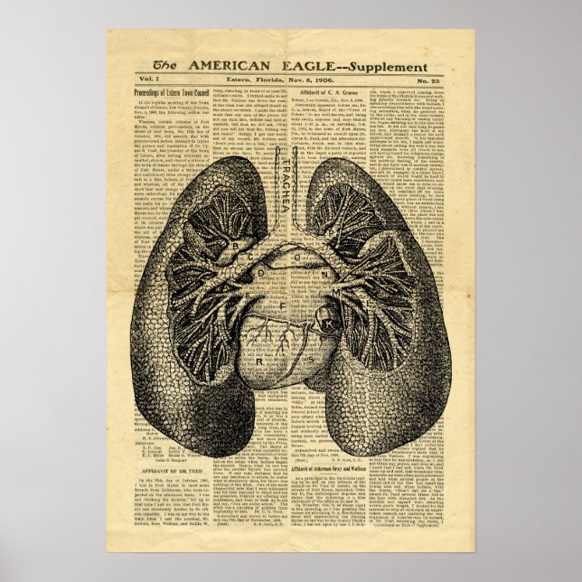 Poster Human Lungs Antique Anatomy on newspaper (Front)