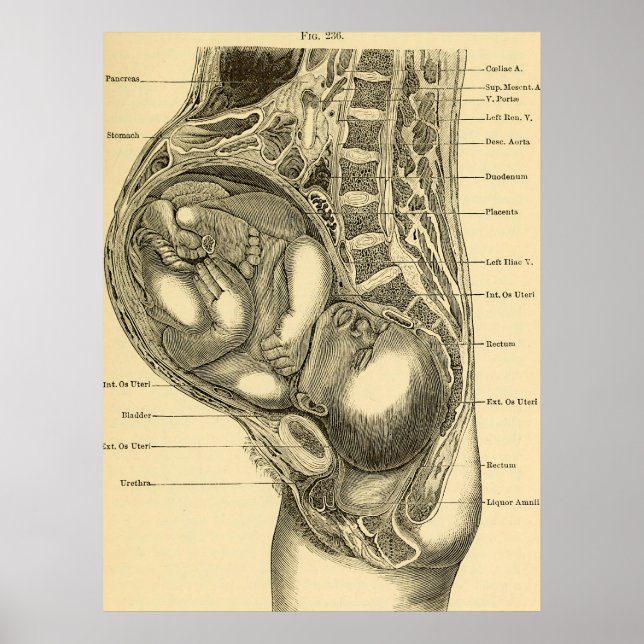 Poster Illustration de l'obstétrique (Devant)
