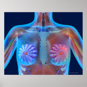 Poster Illustration d'ordinateur représentant le cancer