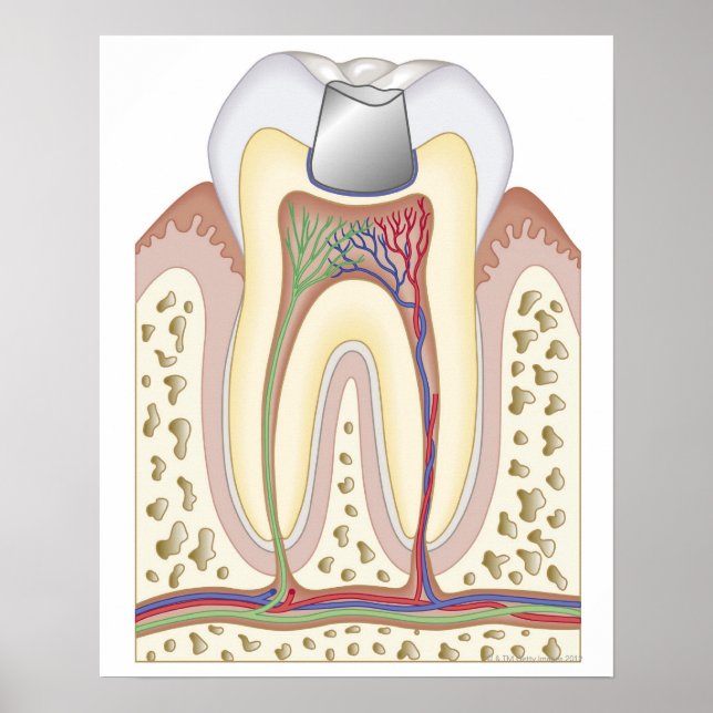 Poster Illustration du remplissage dentaire (Devant)