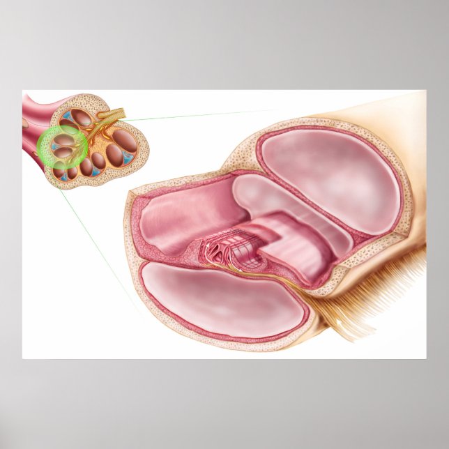 Poster Illustration Médicale D'EndOlymph (Devant)