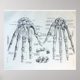 Poster Illustration Médicale des os de la main