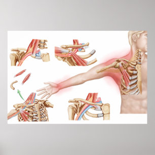 Poster Illustration Médicale Détail de la sortie thoraciq