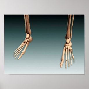 Poster Image conceptuelle des os dans les jambes et les