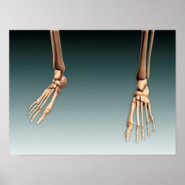 Poster Image Conceptuelle Des Os Dans Les Jambes Et Les P (Devant)