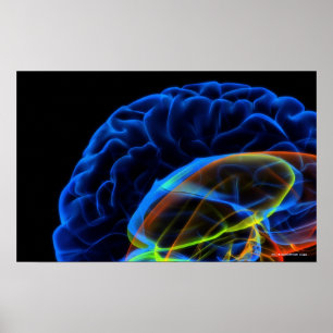 Poster Image de rayon X du cerveau
