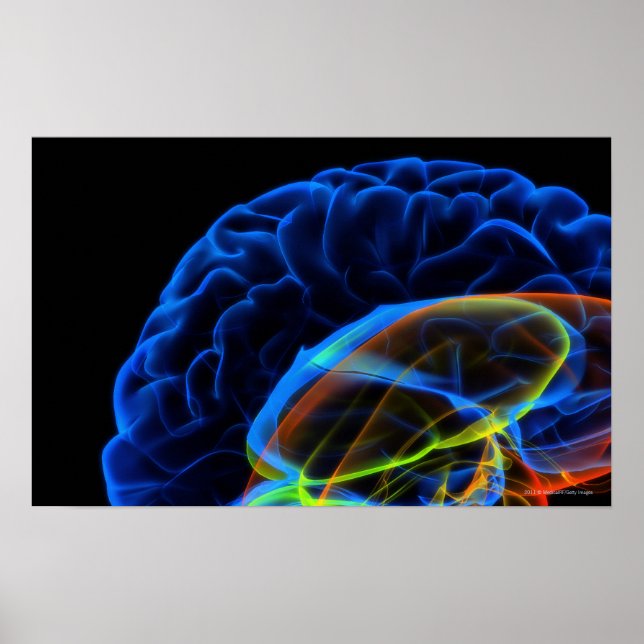 Poster Image par rayons X du cerveau (Devant)