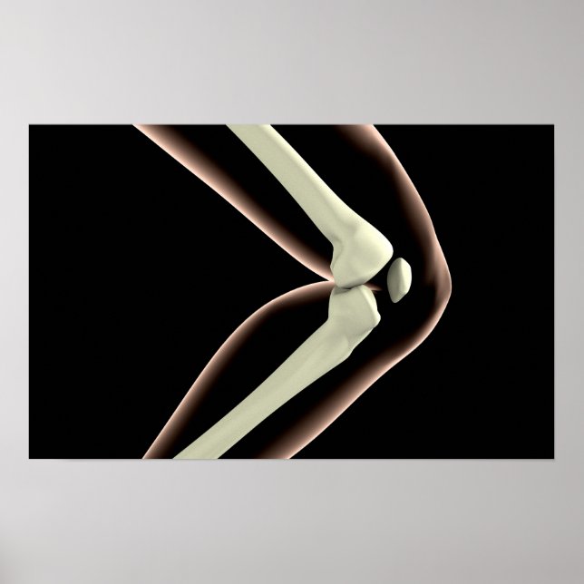 Poster Image X-Ray Du Genou 1 (Devant)
