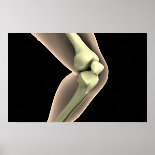 Poster Image X-Ray Du Genou 2
