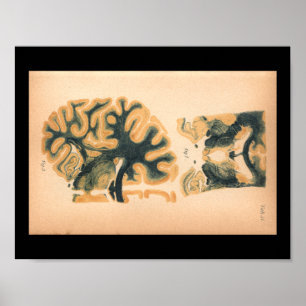 Poster Imprimer l'anatomie cérébrale vintage de 1901