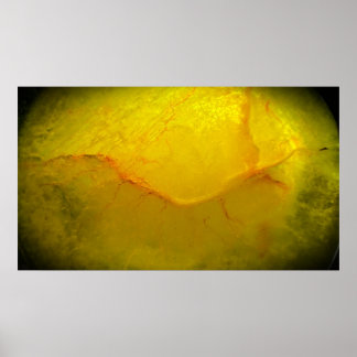 Poster Jaune Abstrait,
