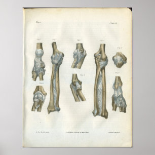 Poster Joints of the Elbow & Arm Anatomy Print