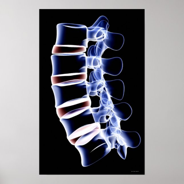 Poster Lumbar Vertebrae (Devant)