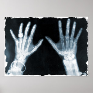 Poster Mains et bijoux en squelette X-Ray - bleu