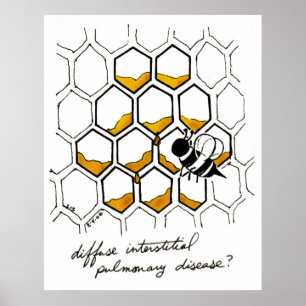 Poster Maladie pulmonaire interstitielle diffuse