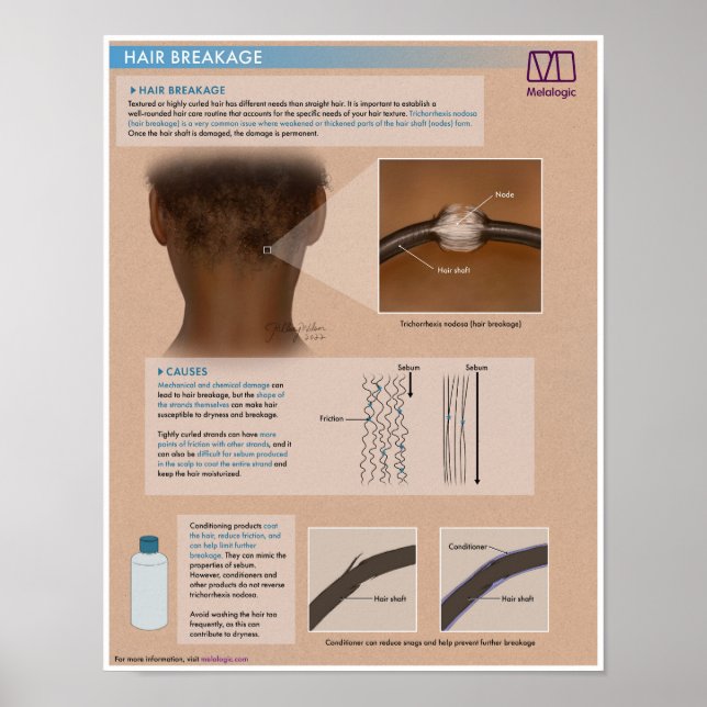 Poster Médicale de la rupture des cheveux de la mé (Devant)